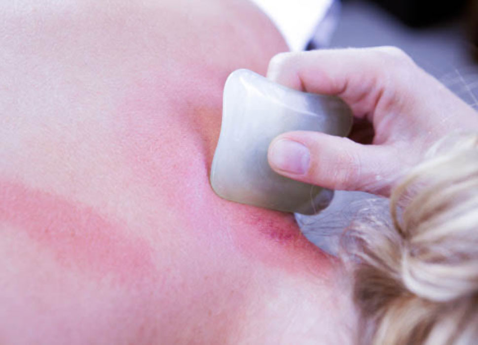 Gua Sha being performing on the back of a persons neck