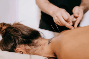 medicare covers acupuncture