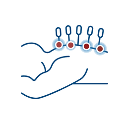 Dry_Needling
